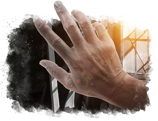 handSkin Image